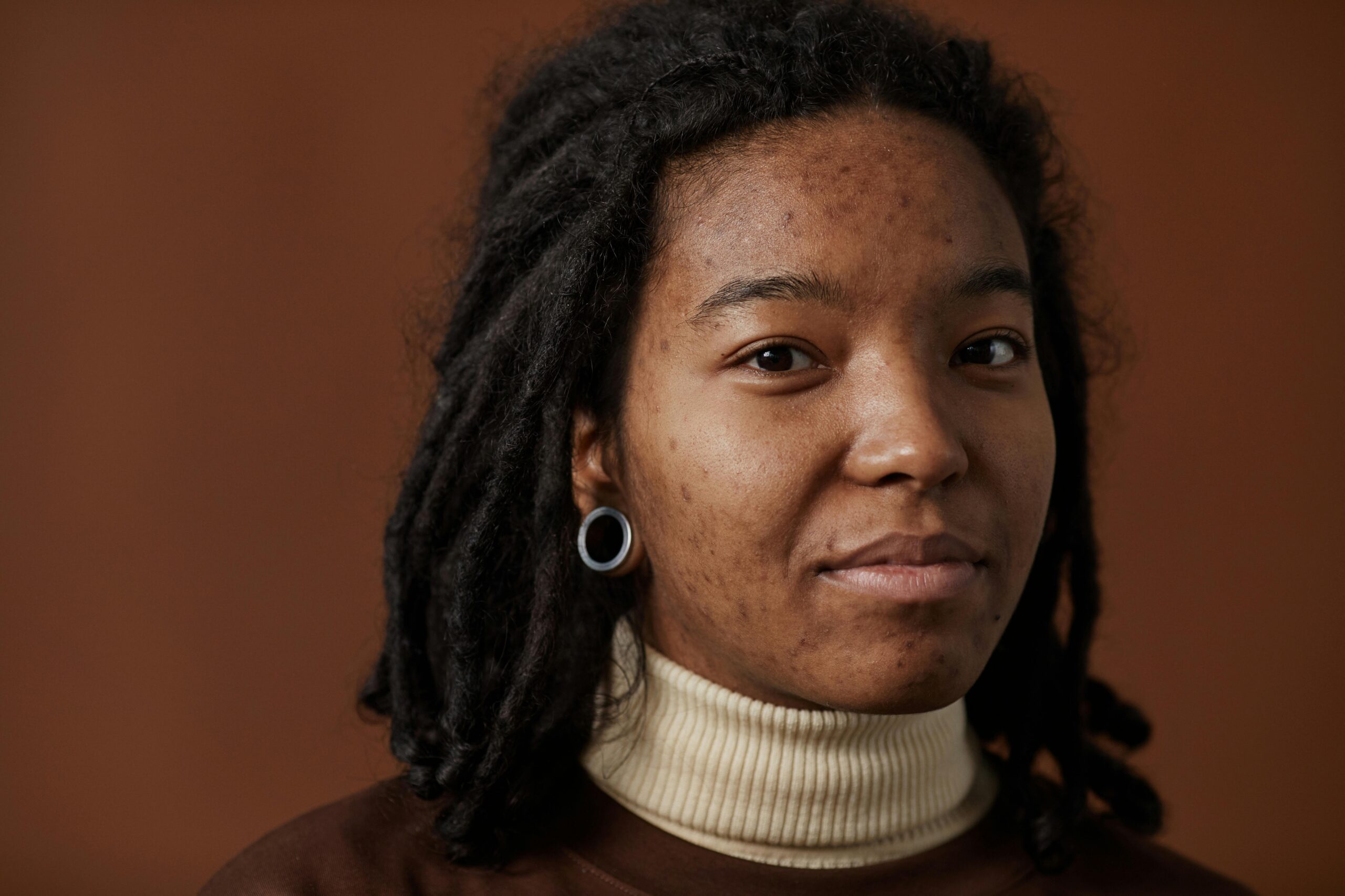Close-up of a smiling woman with natural hair and visible acne in a studio setting.